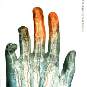 Napier's Bones