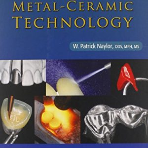 Introduction to Metal-Ceramic Technology